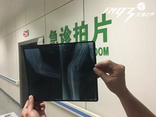 朋友圈无需点赞