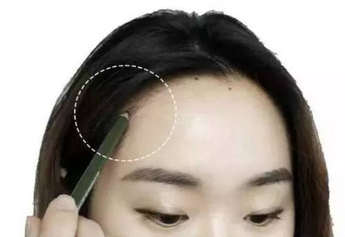 发际线怎么调整?发际线调整教程推荐