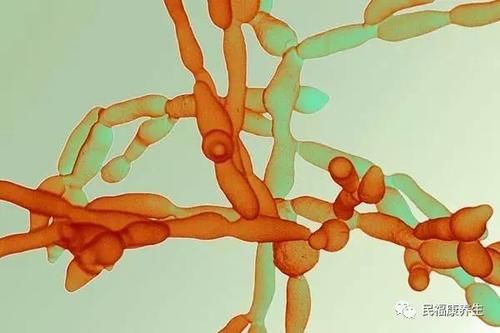 霉菌性阴炎怎么根治 霉菌性阴炎这样吃药好