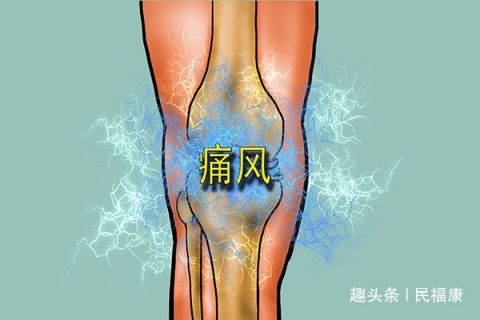 尿酸高会引发痛风吗 2种食物可能升高尿酸