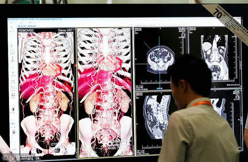一项新技术将改善心脏病病患MRI的体验