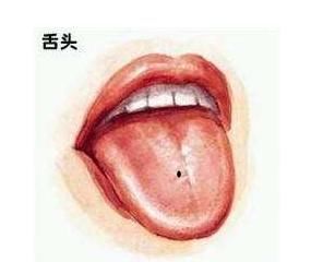 痣相分析：代表女人“一生好运”的10种吉痣