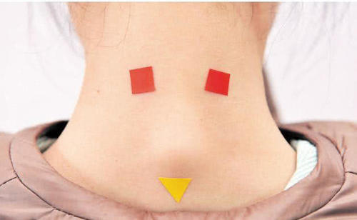 脖子后边有个包?可能是富贵包,注意点,它带来