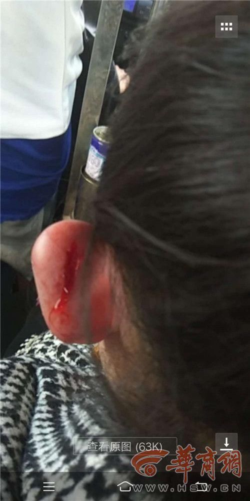 神木一幼儿园女童放学回家耳朵流血 老师发短