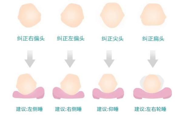 男生!本想给宝宝睡个好看的发型,没想到却烫发悲剧酿成头型哪种漂亮图片搜索图片