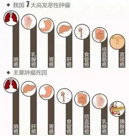 这种癌不痛不痒，一发现就是晚期!身体出现4个信号是警报