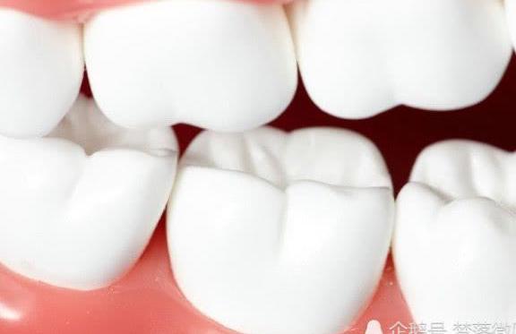 为什么牙医说你的智齿不能拔?和6种病症脱不