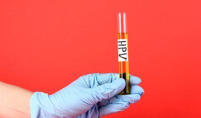 hpv九价疫苗没用