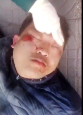 【3.16 晚安沙河】环卫司机见义勇为|寻找受伤