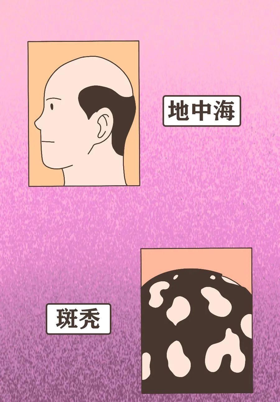 真男人，都容易秃