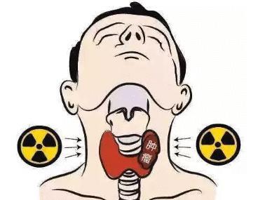 甲状腺瘤的早期症状有哪些 长了甲状腺瘤怎么