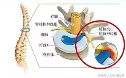 中老人年人腿抽筋，别盲目补钙！这些才是真正原因……