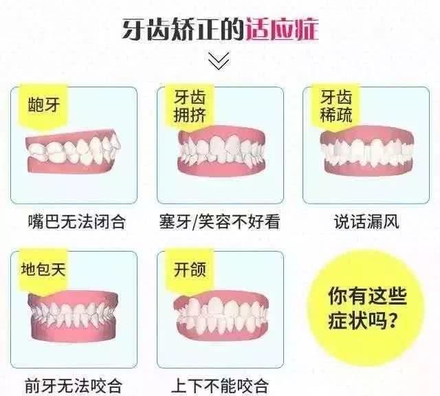 补牙医保可以报销吗
