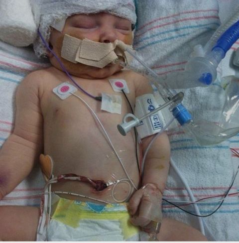 男婴的脑袋里被插了十根针,真相让所有人都愤