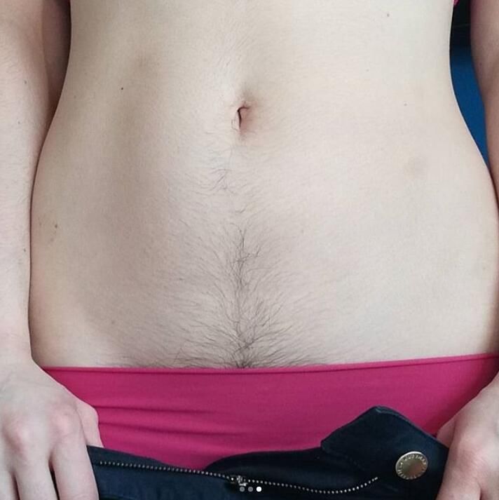 女子无毛便是德?不，有体毛的姑娘也可以很性感!