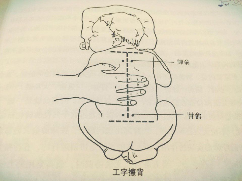 济南小儿推拿李波老师:宝宝流鼻涕可以用中医
