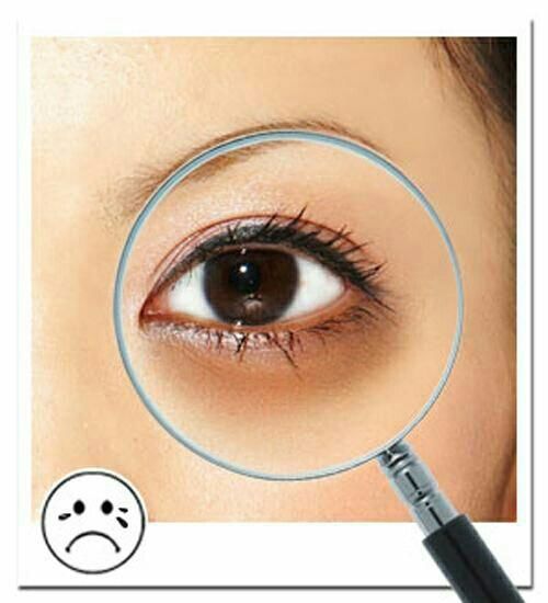 苹果皮可以去黑眼圈、去痘印吗?