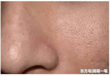 毛孔粗大皮肤粗糙,你该做这么管理皮肤,收细毛孔紧致肌肤!