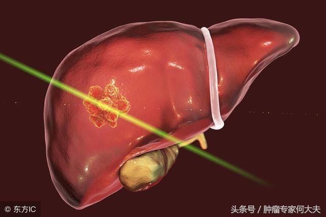 31岁查出乙肝，41岁确诊肝癌晚期，假设再给他10年，或许能幸免