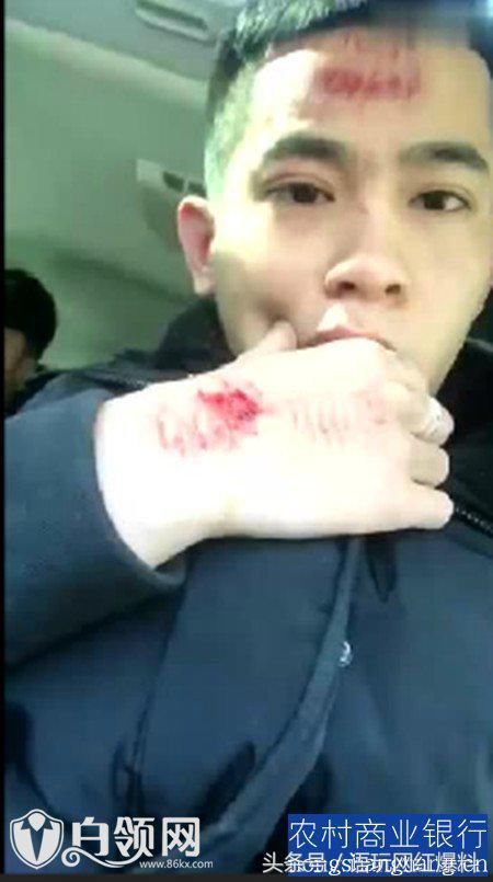 MC吴迪与MC祥龙的殴打事件中吴迪被打伤后