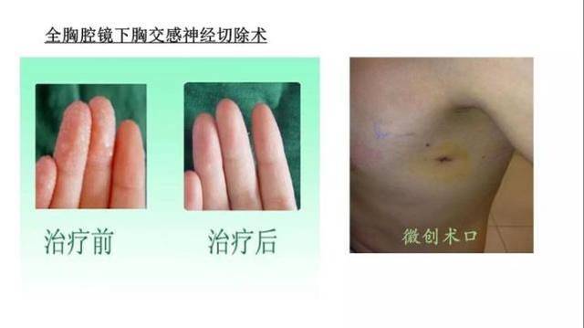 18岁的姑娘不敢跟人握手她意思了?男生女生拍什么是这是肩膀图片