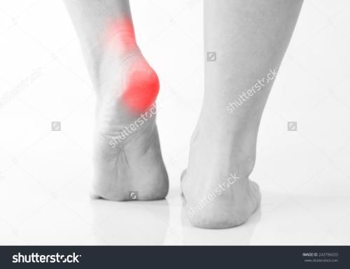 【母婴知识讲座】生孩子落下脚跟疼的月子病,