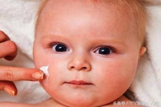 妈妈必修课,这些湿疹是宝宝身体排毒的表现
