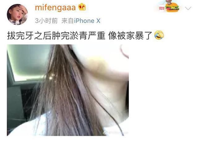 韦神女友微博晒照，称自己被“家暴”了？网友：实锤死亡猪告！