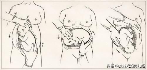 孕28周起增加胎位检查,孕妈妈了解多少?什么原