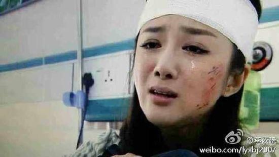 在这之后呢,李依晓做了面部修复手术,脸也被吐槽"塑料",微博自拍画风