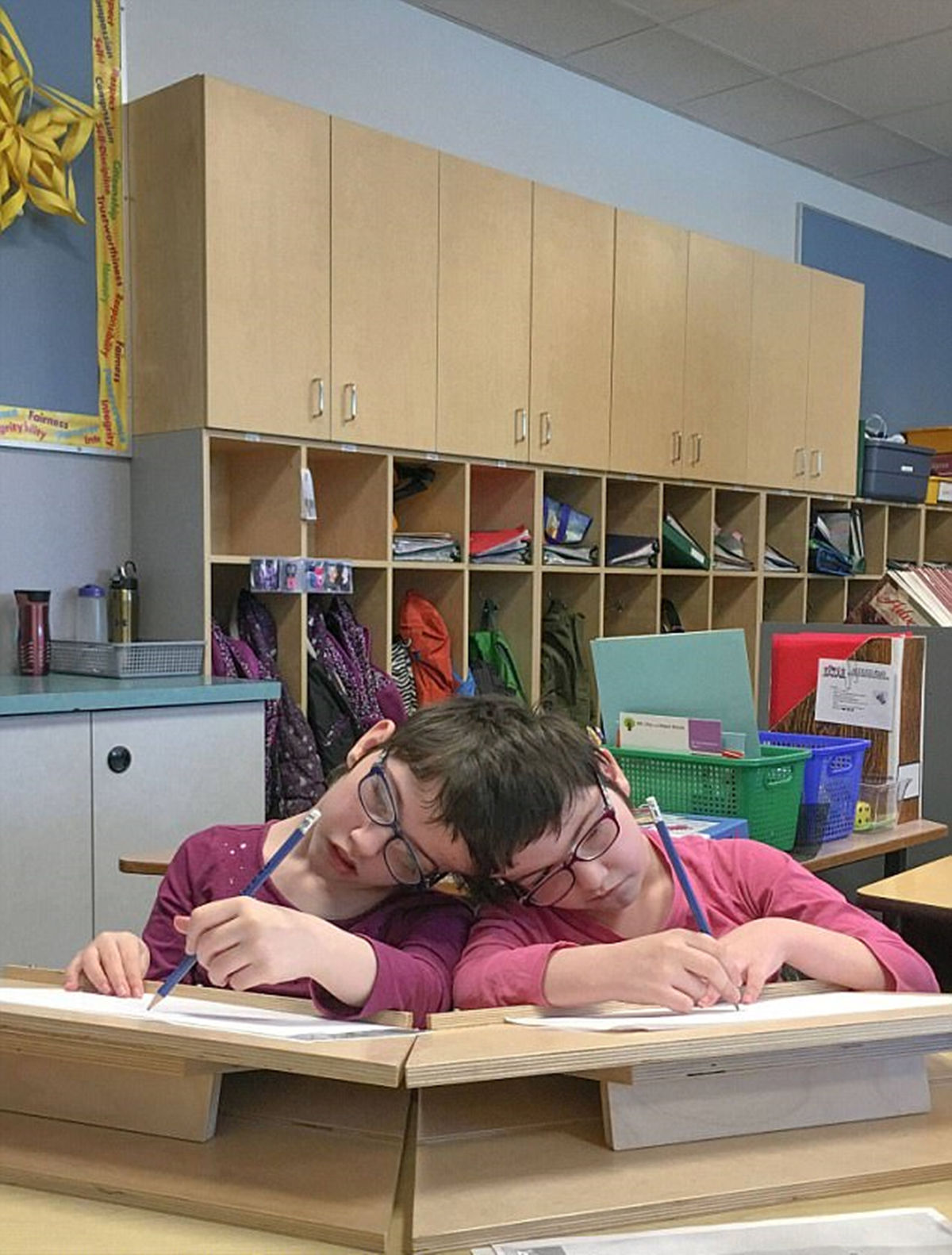 这对暹罗连体人出生时医生说她们只能活一天,