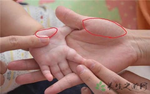 小儿肺炎怎么推拿