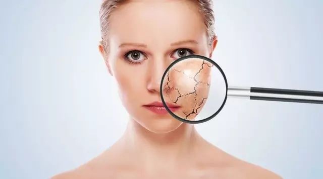 冬季皮肤干燥、脱屑还瘙痒,到底应该怎么做?