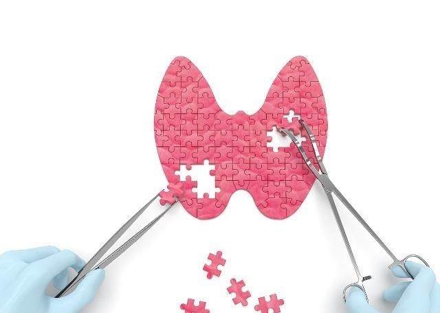 甲状腺结节费用