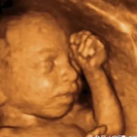 宝妈做四维回来了,确定是男宝宝了,彩超怎么看