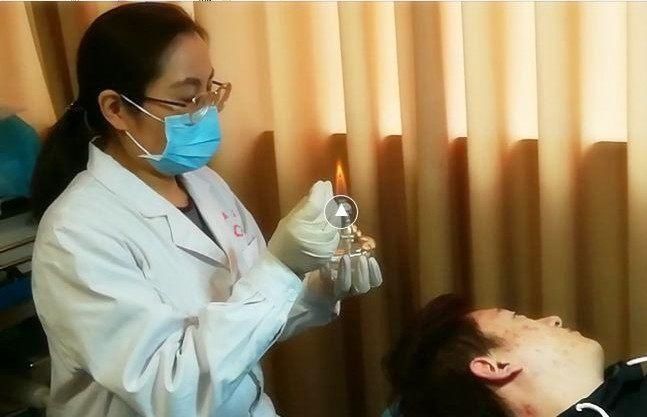新闻丨火针疗法治好了郑州大二学生满脸的青春