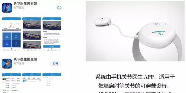 膝关节置换术费用