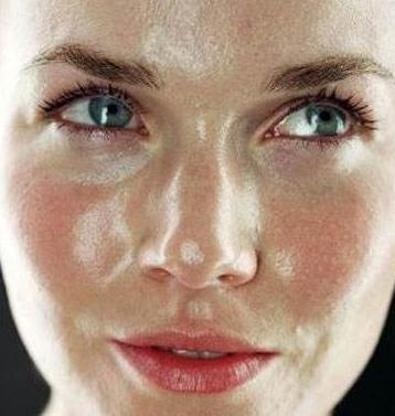 痘痘这里一颗那里一颗, 八成因螨虫在脸上到处