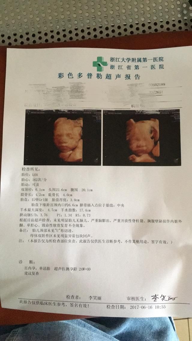 孕期必做的超声B超检查顺产男宝宝,附B超检查