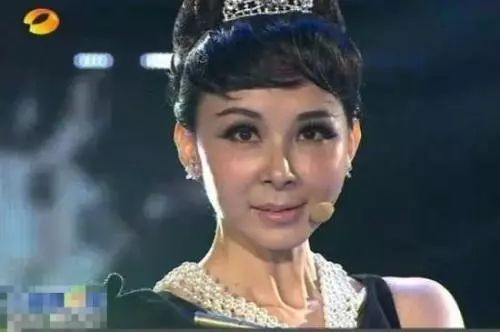 整容后遗症吓死人,金喜善脸僵到嘴歪斜,刘晓庆