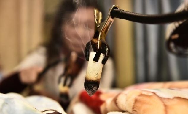 艾灸两年后死亡