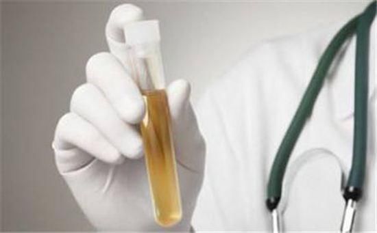 尿液气味重,说明自己的肾脏健康不好了?肾科主