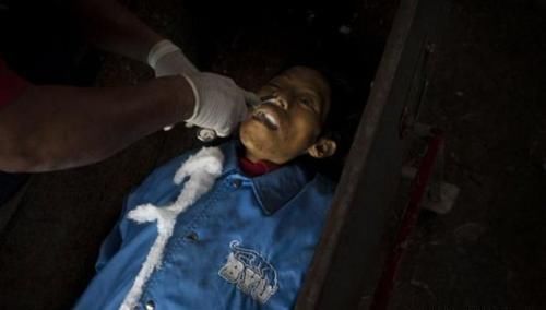 人在死的时候,咽气会不会感到痛苦?