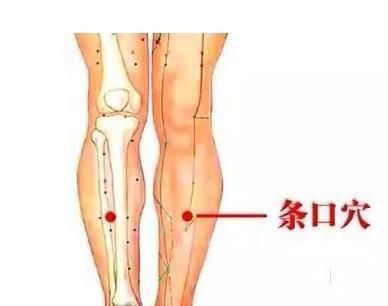 经常性腿抽筋,不仅仅可能是缺钙,还可能是血管
