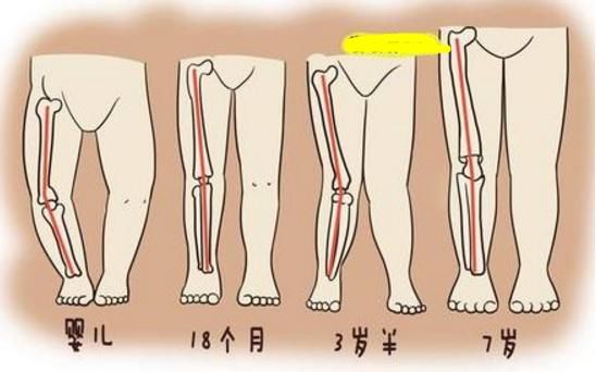 预防宝宝O型腿,新手爸妈一定要避免这三个小习惯,赶紧收藏备用