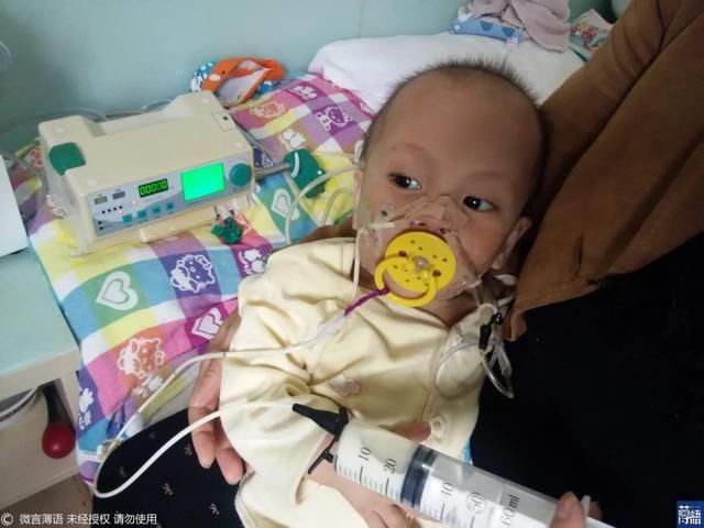 2岁幼童不吃饭仅靠两根管续命，狠心父亲要拔管时娃死死抓住不放