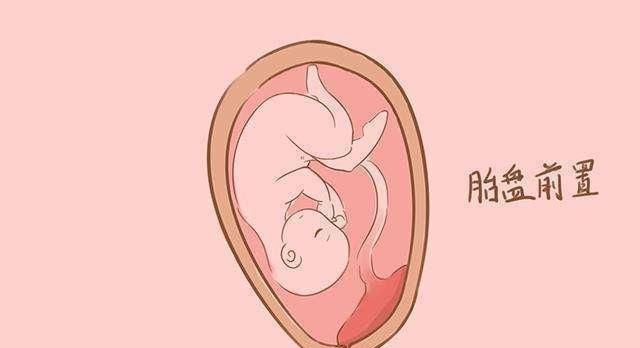 前置胎盘不可不知,可能带来的3个麻烦,原因及预防方法要知道 大发国际app下载