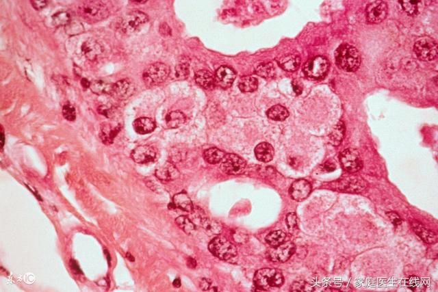 身体出现癌细胞,会有这4个信号,发现一个都要