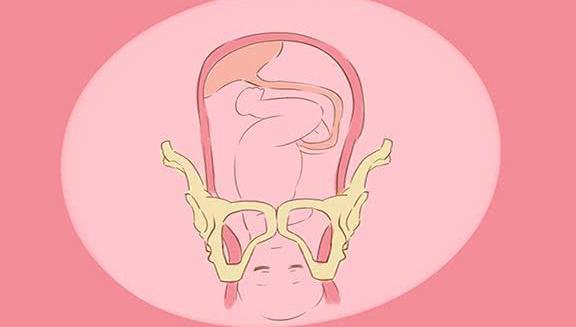 孕妈怀的是一胎还是二胎,在胎儿入盆的时候,差