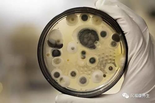 霉菌性阴炎怎么根治 霉菌性阴炎这样吃药好